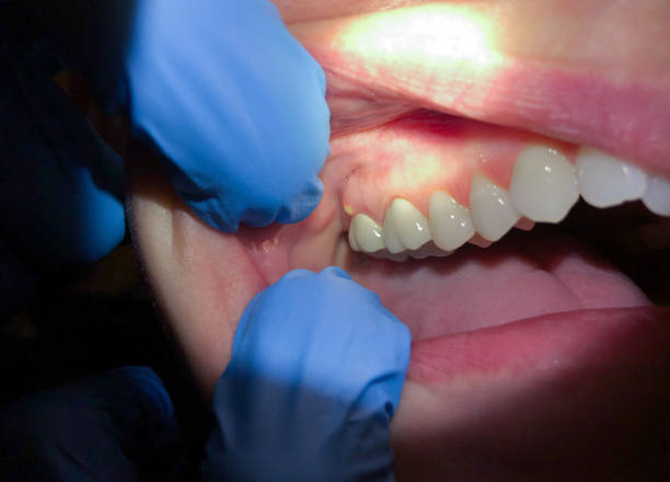 Best Cracked Tooth Emergency Dentist  in Tonganoxie, KS
