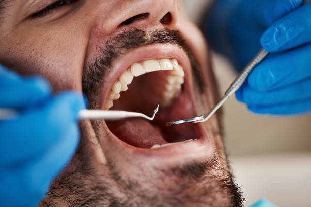 Best Tooth Infection Emergency Dentist  in Tonganoxie, KS