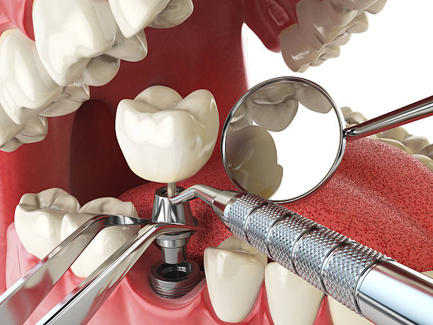 Best Emergency Tooth Extraction  in Tonganoxie, KS
