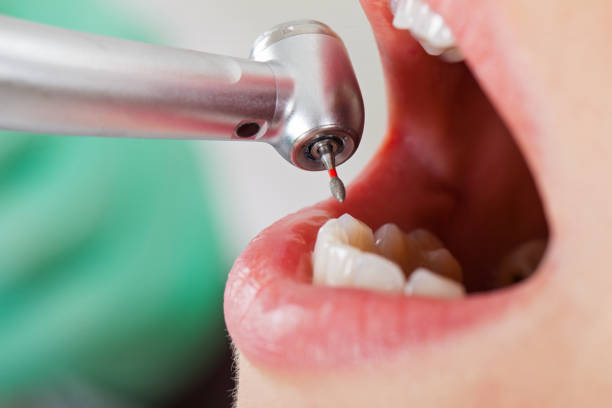 Best Emergency Gum Pain Relief  in Tonganoxie, KS